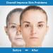 Microcurrent Face & Neck Massager for Wrinkle Reduction and Skin Tightening - Intelligent Facial Device for Contoured Beauty - Blue - Buy Online on SooperMarket.com