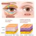AXOEYE Renew Peptide Lifting Eye Gel - OpenEyes Awaken Dark Circle & Wrinkle Cream - Buy Online on SooperMarket.com