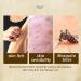 Herbal Anti-Itch Cream for Psoriasis, Dermatitis, Eczema - Multicolor, One Size - Buy Online on SooperMarket.com