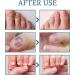 Fungal Nail Treatment - Extra Strong Nail Fungus Treatment for Toenail and Fingernail - Fungal Nail Eliminator Anti fungus Nail Repair and Strengthen Fix & Renew Damaged Broken Nails 30ml - Buy Online on SooperMarket.com