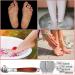 YIMART Foot Corn Removal Cutter Scraper Set - Stainless Steel Callus Remover with 10 Blades - Professional Pedicure Tool for Dead Skin and Cuticles - Buy Online on SooperMarket.com