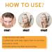 Kojic Acid Soap Kojic Soap Bar Skin Lightening Soap Bath Soap Fades Age Spots Freckles Revitalize and Moisturizing Cleansing Soap for Dark Spots Uneven Skin Tone - Buy Online on SooperMarket.com