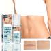 Stretch Mark Gel 2Pcs 50ml with Allantoin & Vitamin E - Hydrating Scar Remover for Scars, Burns & Surgery - Buy Online on SooperMarket.com