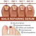 7 Days Nail Growth and Strengthening Serum Nail Serum for Strength and Growth Nail Repair Essence Serum - Buy Online on SooperMarket.com