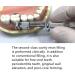 Dental Partial Matricular System Set - 40 Tooth Matrices & Matrix-Tofflemire Holder for Perfect Curvature | International Shipping - Buy Online on SooperMarket.com