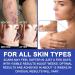 Silicone Scar Sheets 1.6x120 - Scar Removal Tape for Burn, Acne, C-Section & Surgery - Reusable & Washable - Buy Online on SooperMarket.com