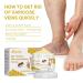 Furzero Bienengift Varicose Veins Cream - Test Winner Spider Vein Relief | 5-Piece Beeergift Pain Cream for Everyone | International Shipping Available - Buy Online on SooperMarket.com