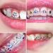 Buy NIKTULE DIY Crystal Tooth Sets - Complete Disch-Edelstein Collection for Men & Women | International Shipping Available - Buy Online on SooperMarket.com