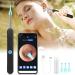 Smart Wireless Ear Wax Removal Tool Camera | Visual Ear Cleaner Kit for Babies, Kids, Adults, Pets | 1296P Ear Otoscope Scope with Cleaning Tool - Buy Online on SooperMarket.com