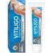 UpdateClassic Vitiligo Cream, Natural Vitiligo Treatment for Skin Vitiligo, Vitiligo Care Cream, Reduce White Spots and Improve Skin Pigmentation, Easy to Use, Blue/Vitiligo