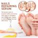 7 Days Nail Growth and Strengthening Serum Nail Serum for Strength and Growth Nail Repair Essence Serum - Buy Online on SooperMarket.com