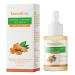 Turmeric and Vitamin C Face Serum  Turmeric Dark Spot Corrector Serum  Turmeric Serum for Dark Spots  Anti Aging Serum  Moisturizing  Soothing  Repair Skin Suitable for All Skin Types - 1oz/30ml