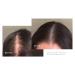 Virtue Flourish Hair Growth Regimen for Women - Minoxidil 5% Foam for Fine & Thinning Hair | Sulfate Free & Color Safe - International Shipping Available - Buy Online on SooperMarket.com