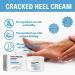 Foot Cream For Very Dry Feet Natural Foot Cream Foot Cream For Calluses And Hard Skin Cracked Heel Repair Balm Coconut Oil Foot Moisturiser Callus Remover Soften For Feet Knees Hand - 50g - Buy Online on SooperMarket.com