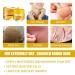 Anti-Dry Skin Foot Cream | Nourishing Moisturizer for Dry Feet - A Size | International Shipping Available - Buy Online on SooperMarket.com
