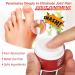 Bunion Pain Relief Cream 10g - Natural & Portable Solution for Back, Neck, Knee, Hand, Wrist, Shoulder, and Feet - Buy Online on SooperMarket.com