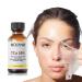 50% Citric Acid Peeling Serum  Chemical Peel for Face  Peeling Solution Skin Peel  Chemical Exfoliant for Face  Exfoliating Facial Peel for Dark Skin  Dark Spots  Acne Spot - 30ml/1 Fl oz