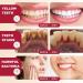SP-6 Probiotics Ultra Whitening Toothpaste - Deep Cleaning & Fresh Breath 2PCS - Brighten Teeth & Remove Stains - Buy Online on SooperMarket.com
