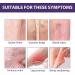Varicose Vein & Spider Vein Cream | Capillary Health Treatment | Improve Circulation 0.7oz - Buy Online on SooperMarket.com