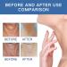 Neck Firming Serum Rapid Lift Advanced Neck Serum Neck Firming Cream Black Neck Remover Neck Lift Skin Tightening for Fine Lines and Wrinkles on the Neck Repair Sagging Skin - Buy Online on SooperMarket.com