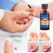 Extra Strength Toe Nail Fungus Treatment - Effective Nail Repair Solution for Healthy Nails - Buy Online on SooperMarket.com