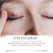 Stye Eye Treatment & Chalazion Remover | Eye Relief Serum & Gentle Lash Cleanser - Fast International Shipping - Buy Online on SooperMarket.com