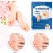 MQUPIN Corn Remover Pads Wart Remover Pads Foot Corn Remover Pads Plantar Wart Removal Corn Callus Remover Penetrates and Removes Common and Plantar Warts with Hole Callus Stops Wart Regrowth (24 PCS) - Buy Online on SooperMarket.com
