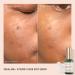 Biossance Squalane + Vitamin C Dark Spot Serum - 10% Vitamin C for Brightening, Dark Spot Reduction, and Pigmentation Control (1.01 oz) - Buy Online on SooperMarket.com