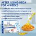 Smilamo Heca Natural Herbal Hemorrhoid Capsules - Rapid Relief Treatment (1 Pcs) - Buy Online on SooperMarket.com
