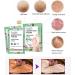 Joyeee Foot Peel Mask for Hard Skin 4 Pairs Exfoliating Foot Peeling Mask Foot Peel Socks for Removes Calluses and Hard Skin Foot Care For Men and Women B#4 Pairs - Buy Online on SooperMarket.com