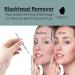 Glamified Blackhead Remover Professional Skincare Spot Treatment Blackhead Remover Tool for Blemish Comedone Whiteheads Pimple Popper with Double Sided Soft Touch and Anti-Slip Design - Buy Online on SooperMarket.com