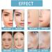 Nmbol Skin Lightening Serum B5 Spot Correction Serum B5 Corrector Serum Pigment Spot Remover Serum B5 Against Pigment Spots Wrinkle Reduction and Adolescent Radiation - Buy Online on SooperMarket.com