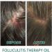 FIOERDTUIE Adults Hair Growth Essential Oil Follicle Repair Moisturizing Nourishing Essence Haircare Serum Beauty Supplies - Buy Online on SooperMarket.com