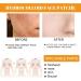 Pimple Patches for Face Hydrocolloid Surface Patches for Forehead Nose Chin and Cheeks Large Acne Treatment Patches for Pimple Extraction and Clean Pores Hydrocolloid Acne Patches for Acne Skin - Buy Online on SooperMarket.com