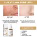 2022 Turmeric Dark Spot Corrector Serum for Face - Natural Skin Care Moisturizing Serum (2PCS-60ml) - Buy Online on SooperMarket.com
