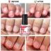 Teksome Nail Biting Polish For Kids | 10ML Anti Bite Nail Polish | Stop Nail Biting Finger Nail Biting Polish Stop Biting Nails Kids Dual-Effect For Kids And Adults - Buy Online on SooperMarket.com
