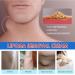 Lump-Free Lipoma Removal Ointment - Natural Vegetable Formula for Anti-Swelling & Skin Care - Hyper Havoc (White, One Size) - Buy Online on SooperMarket.com