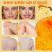 Turmeric Body Scrub Turmeric Scrub with Vitamin C Natural Face Exfoliator Scrub Exfoliating Body Scrub With Turmeric Turmeric Body Scrub For Neck Armpit Back Skin Care Scrub 150G/5.29OZ - Buy Online on SooperMarket.com