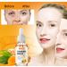 Turmeric Dark Spot Corrector Serum 2 PCS - Natural Facial Serum for Hyperpigmentation, Age & Sun Spots - Moisturizing Essence for Women & Men - 1Fl Oz (Pack of 2) - Buy Online on SooperMarket.com