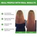 Rosemary Hair Growth Oil & Serum - Dry Scalp Treatment for Women | Hair Thickening & Essential Oil (2OZ) - Boost Hair Growth & Combat Hair Loss - Buy Online on SooperMarket.com
