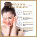 Rice toner facial water rice moisturizer for the face Feuchtigkeitsspendender rice extract toner for dry sensitive skin depth Feuchtigkeitsversorgung 150ml - Buy Online on SooperMarket.com