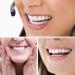 LAMILL 2PCS Fake Teeth - Instantly Cover Imperfect Teeth - Restores and Enhances Smile - One Size Fits All - Buy Online on SooperMarket.com