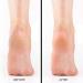 Extra Strength Callus Remover Gel 8oz - Salon Grade Pedicure Supplies for Rough, Dry Skin - Heavy Duty Foot Callus Remover with Cool Mint - Professional Home Treatment - Buy Online on SooperMarket.com