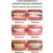2PC SP-6 Ultra Whitening Toothpaste Probiotic Teeth Lightening Formula for Brilliant Smiles | International Shipping Available - Buy Online on SooperMarket.com