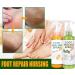 Anushka Foot Peeling Spray Oil | Quick Dead Skin Removal & Hydrating Exfoliation | Effective Callus Treatment - Buy Online on SooperMarket.com