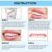 CAILING Snap On Veneers for Missing Teeth - 6 Sets Instant Denture Filling Kit - Fake Braces for Realistic Looking Teeth - Buy Online on SooperMarket.com