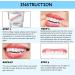 Cailong Instant Veneers & Whitening Kit - 4 Pairs for Snap-On Temporary Tooth Covering & Filling - Sensitive Teeth Friendly - Buy Online on SooperMarket.com