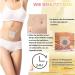 Todahof Bee Venom Slimming Patch - Lymphatic Drainage & Body Shaping for Men & Women (3 Boxes) | Best International Shipping - Buy Online on SooperMarket.com