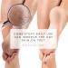 Moisturizing Gel Heel Socks - Heal Dry Cracked Feet | Lavender & Jojoba Infusion | Perfect Gift (1 Pair Pink - Buy Online on SooperMarket.com