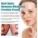 Fade Stain Beauty Cream Freckle Remover Cream Dark Spot Remover for Face Age Spot Remover Corrector Cream for Face and Body Dark Spot Remover Dark Spot Remover for Face and Body - Buy Online on SooperMarket.com